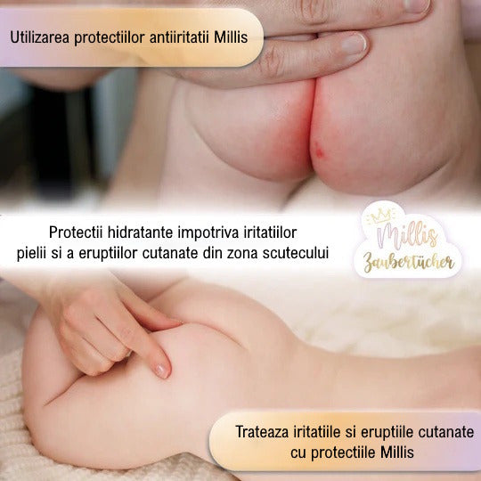 Millis Protectii Antiiritatii pentru Bebelusi Magic 25 buc